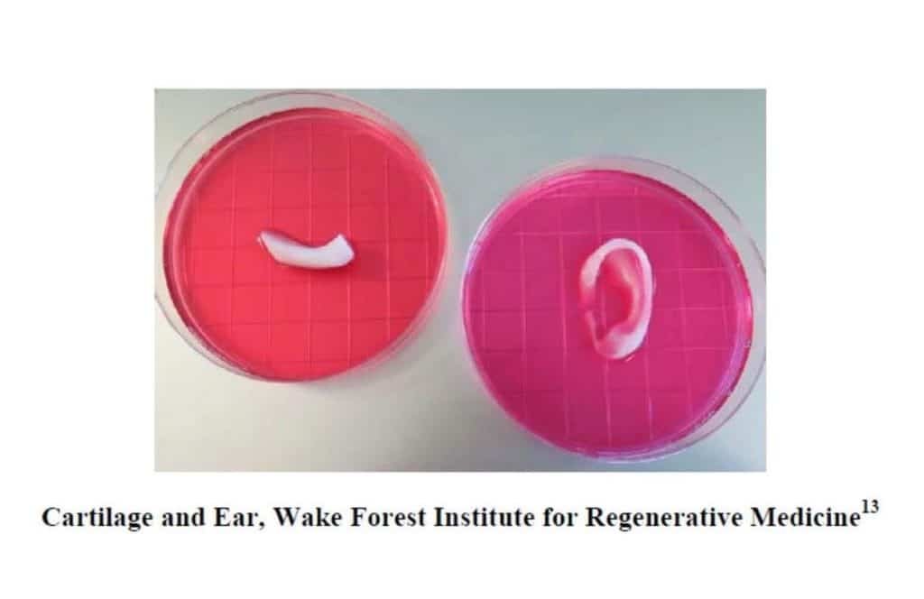 3D printed cartilage-and-ear